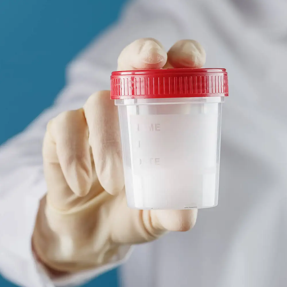 sperm donation cyprus